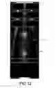 Fig. 12 - Non-lethal ammunition projectile