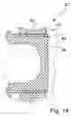 Fig. 07 - Electrically driven camshaft adjuster