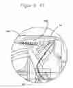 Fig. 19 - Dual piston rotary engine