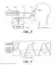Fig. 03 - Ventilatory Stabilization Technology