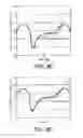 Fig. 12 - Ventilatory Stabilization Technology