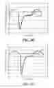 Fig. 15 - Ventilatory Stabilization Technology