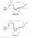 Fig. 19 - Ventilatory Stabilization Technology