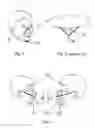 Fig. 03 - Flat-foldable face-mask and process of making same