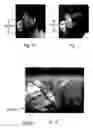 Fig. 07 - Flat-foldable face-mask and process of making same