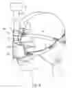 Fig. 03 - Full-face mask and mask cushion therefor