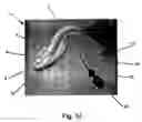 Fig. 02 - Laryngeal mask and a method manufacturing same