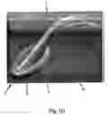 Fig. 05 - Laryngeal mask and a method manufacturing same