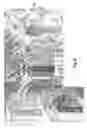 Fig. 10 - Laryngeal mask and a method manufacturing same