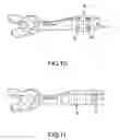 Fig. 07 - Multifunctional mouthpiece system