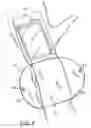 Fig. 07 - Apparatus for carrying items