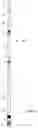 Fig. 13 - Methods and devices for one trip plugging and perforating of oil and gas wells