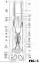 Fig. 10 - Methods and apparatus for cementing drill strings in place for one pass drilling and completion of oil and gas wells