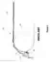 Fig. 02 - Conveyor belt wiper
