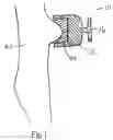 Fig. 02 - Custom molded nipple replicating a human nipple for use in both pacifiers and baby bottles