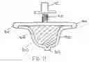 Fig. 12 - Custom molded nipple replicating a human nipple for use in both pacifiers and baby bottles