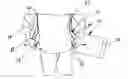 Fig. 01 - Clip support member for golf bag