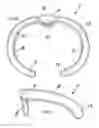 Fig. 05 - Clip support member for golf bag