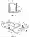 Fig. 02 - Bucket stabilizing apparatus