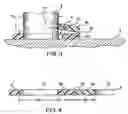 Fig. 03 - Bucket stabilizing apparatus