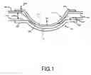 Fig. 02 - Multi stage ophthalmic lens demold