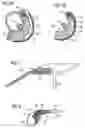 Fig. 02 - Vehicle occupant protection device