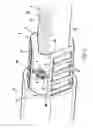 Fig. 02 - Telescoping steering shaft
