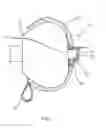 Fig. 02 - Door knob cover