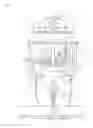 Fig. 06 - Dismounting device for heavy load hoisting sling