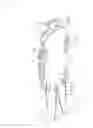 Fig. 16 - Dismounting device for heavy load hoisting sling