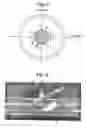 Fig. 07 - Apparatus for magnetic resonance imaging