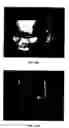 Fig. 02 - Systems and methods to optimize volumetric rendering of a region of interest (