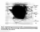 Fig. 04 - Systems and methods to optimize volumetric rendering of a region of interest (