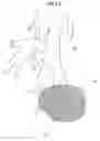 Fig. 11 - Insertion support system