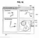 Fig. 19 - Insertion support system
