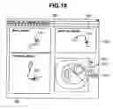 Fig. 20 - Insertion support system