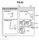 Fig. 23 - Insertion support system