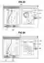 Fig. 35 - Insertion support system
