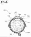 Fig. 05 - Ophthalmologic surgical microscope having focus offset