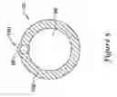 Fig. 06 - Intravascular filter with centering member