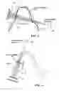 Fig. 03 - Dental extra-oral x-ray imaging system and method