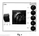 Fig. 04 - Hearing aid fitting system with a camera