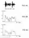 Fig. 07 - System and method for real time lip synchronization