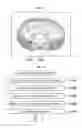 Fig. 11 - Apparatus and method of supporting diagnostic imaging for medical use