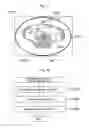 Fig. 13 - Apparatus and method of supporting diagnostic imaging for medical use