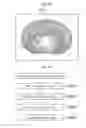 Fig. 16 - Apparatus and method of supporting diagnostic imaging for medical use