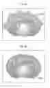 Fig. 17 - Apparatus and method of supporting diagnostic imaging for medical use