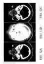 Fig. 13 - Method and system for providing defective cell correction in a medical imaging device