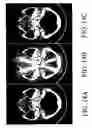 Fig. 15 - Method and system for providing defective cell correction in a medical imaging device