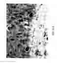 Fig. 16 - Method for quantitative video-microscopy and associated system and computer software program product